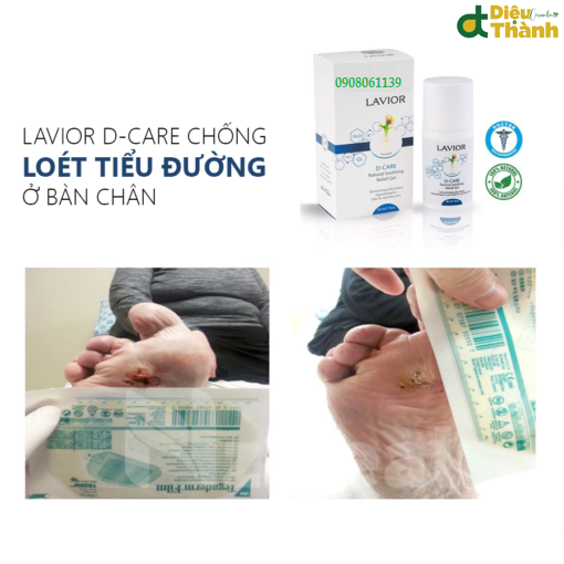Kết quả dùng LAVIOR Diabetic Wound Gel - GEL CHỐNG LOÉT TIỂU ĐƯỜNG ở bàn chân